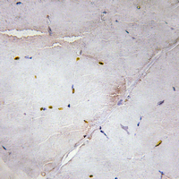 19 - Anti-LATS2 Antibody AP54116