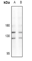 1 - Anti-LATS2 Antibody AP54116