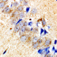 19 - Anti-Collagen 4 alpha 4 Antibody AP54117