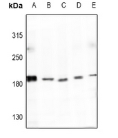 1 - Anti-Collagen 4 alpha 4 Antibody AP54117