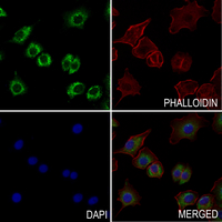 3 - Anti-GALM Antibody AP54119