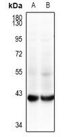 1 - Anti-GALM Antibody AP54119