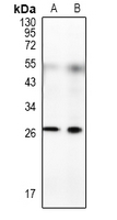 1 - Anti-RFPL4B Antibody AP54121