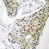19 - Anti-TCEAL3/5/6 Antibody AP54122