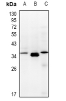 1 - Anti-TCEAL3/5/6 Antibody AP54122