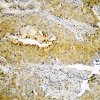 19 - Anti-ECM1 Antibody AP54123