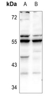 1 - Anti-Fetuin B Antibody AP54125