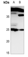 1 - Anti-Histone H1 Antibody AP54126