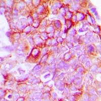 19 - Anti-EPHB1/2 Antibody AP54131