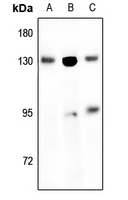 1 - Anti-EPHB1/2 Antibody AP54131