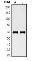 1 - Anti-Cytokeratin 6 Antibody AP54133