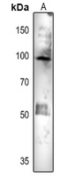 1 - Anti-ACO1 Antibody AP54153