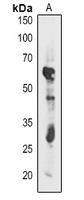 1 - Anti-atpB Antibody AP54155