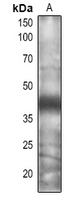 1 - Anti-CSN5A/B Antibody AP54158