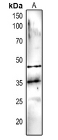 1 - Anti-DEGP5 Antibody AP54162