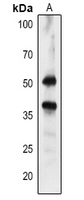 1 - Anti-HPR Antibody AP54165