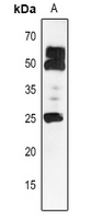 1 - Anti-HSP25.3 Antibody AP54166