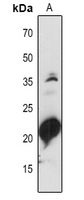 1 - Anti-PSAD1/2 Antibody AP54171