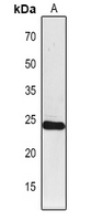 1 - Anti-PSAF Antibody AP54172