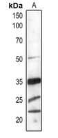 1 - Anti-PSBO1/2 Antibody AP54173
