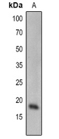 1 - Anti-SCE1 Antibody AP54174