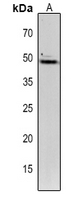 1 - Anti-TIC40 Antibody AP54175