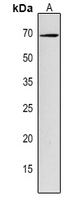 1 - Anti-VHA-A Antibody AP54176