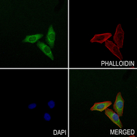 3 - Anti-Collagen 10 alpha 1 Antibody AP54177