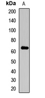 1 - Anti-Collagen 10 alpha 1 Antibody AP54177