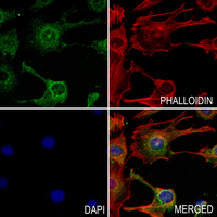3 - Anti-ABCB7 Antibody AP59471