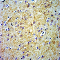 19 - Anti-ABCB7 Antibody AP59471