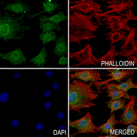 3 - Anti-Gamma-actin-1 Antibody AP59472