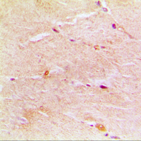 19 - Anti-Gamma-actin-1 Antibody AP59472