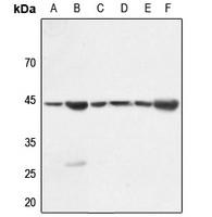 1 - Anti-Gamma-actin-1 Antibody AP59472