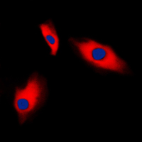 3 - Anti-Alpha-actin-3 Antibody AP59473