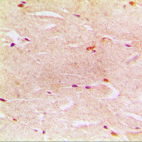 19 - Anti-Alpha-actin-3 Antibody AP59473