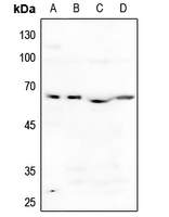 1 - Anti-ACVR1B Antibody AP59474