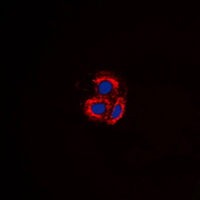 3 - Anti-ALK1 Antibody AP59475