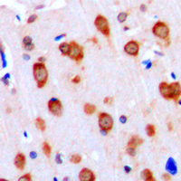 19 - Anti-ALK1 Antibody AP59475
