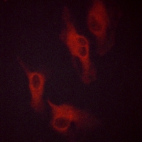3 - Anti-Beta-2 Adrenergic Receptor (Phospho-S346) Antibody AP59476