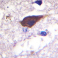19 - Anti-Beta-2 Adrenergic Receptor (Phospho-S346) Antibody AP59476