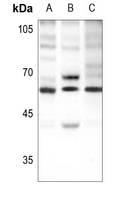 1 - Anti-Beta-2 Adrenergic Receptor (Phospho-S346) Antibody AP59476