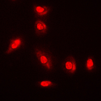 3 - Anti-AKT (Phospho-Y315) Antibody AP59477