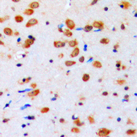 19 - Anti-AKT (Phospho-Y315) Antibody AP59477