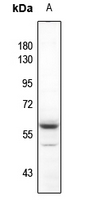 1 - Anti-AKT (Phospho-Y315) Antibody AP59477
