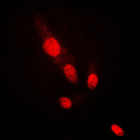 3 - Anti-AKT2 Antibody AP59478