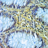 19 - Anti-ALDH1B1 Antibody AP59479