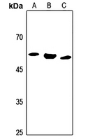 1 - Anti-ALDH1B1 Antibody AP59479