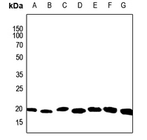 1 - Anti-ARF6 Antibody AP59481