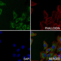 3 - Anti-Arginase 2 Antibody [KO/KD Validated] AP59482